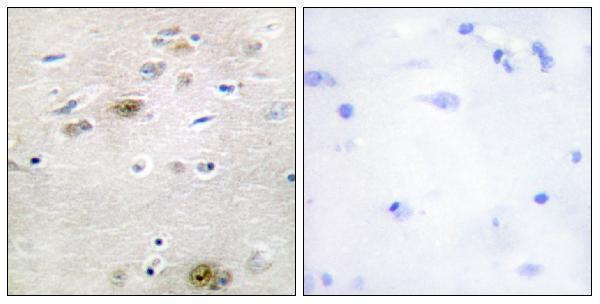 a03770 tra2a primary antibodies ihc testing 4
