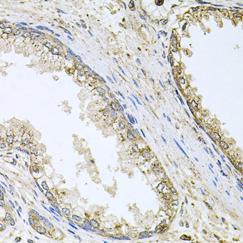 Immunohistochemistry of paraffin-embedded human prostate using CYP46A1 antibody at dilution of 1:100 (x40 lens)