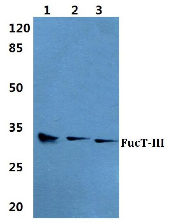 a03774 1 fut3 primary antiboties wb testing 1