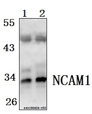 Western blot (WB) analysis of FGF5 polyclonal antibody at 1:500 dilution
Lane1:The fetal brain tissue lysate of Mouse(40ug)
Lane2:The fetal brain tissue lysate of Rat(40ug)