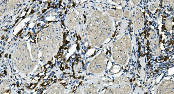 a03780 2 ms4a1 primary antibodies ihc testing 4