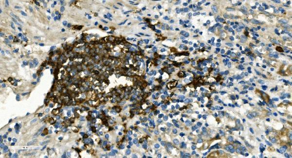 a03780 2 ms4a1 primary antibodies ihc testing 5