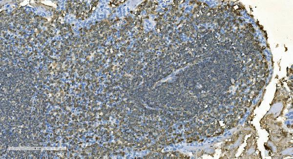 a03780 2 ms4a1 primary antibodies ihc testing 8