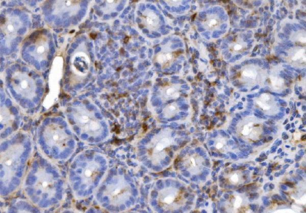 a03780 3 cd20 primary antibodies ihc testing 2