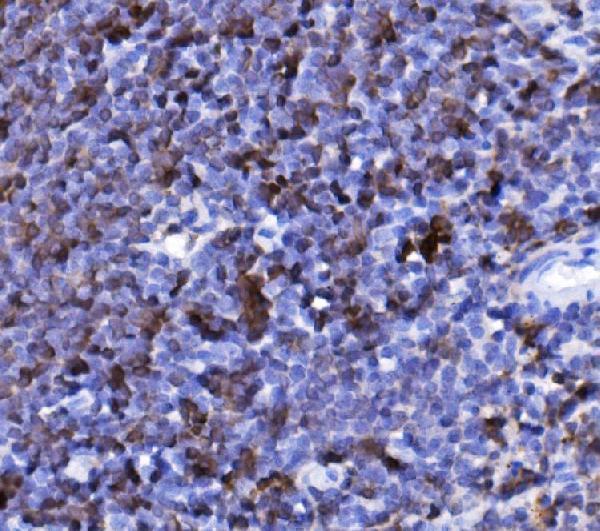 a03780 3 cd20 primary antibodies ihc testing 3