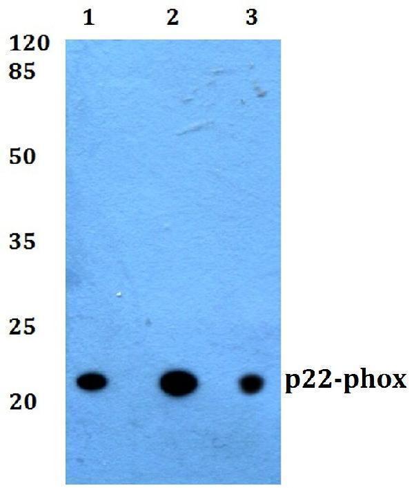 a03781 cyba primary antiboties wb testing 1