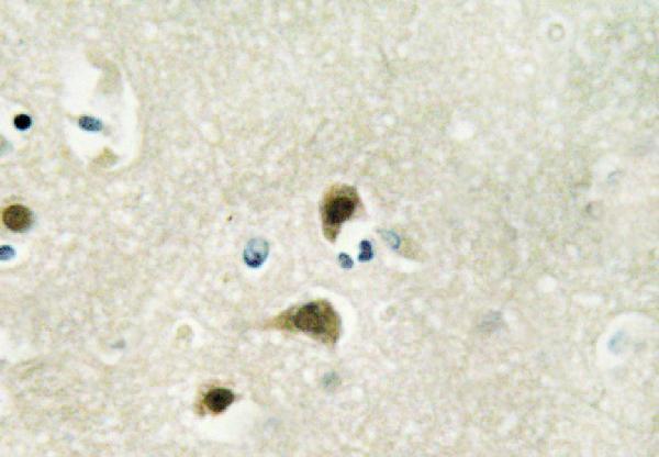 a03783 2 mknk1 primary antiboties ihc testing 2