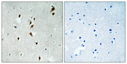 Immunohistochemistry validation of MKNK1 using Anti-Phospho-Mnk1 (T385) MKNK1 Antibody (A03783T385)