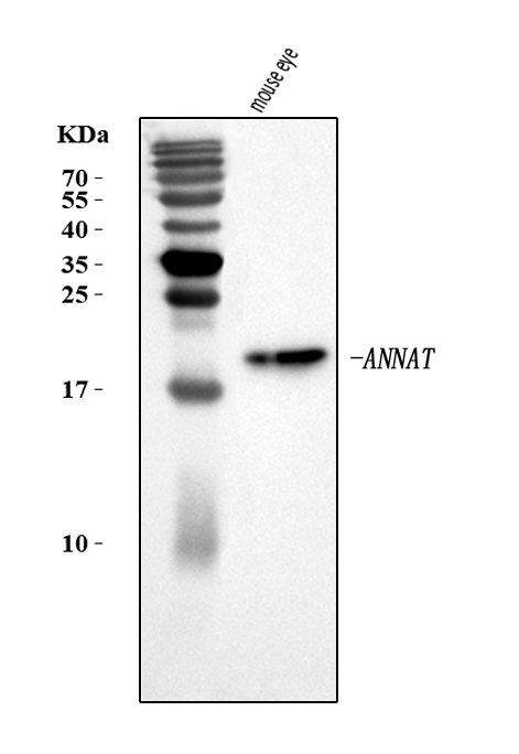 Western blot analysis of Aanat using anti-Aanat antibody (A03784-1)