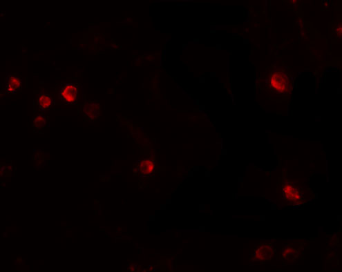 Immunofluorescence of USP10 in Jurkat cells with USP10 antibody at 20 μg/mL