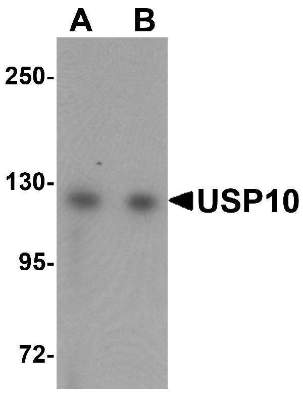 Western blot analysis of USP10 in Jurkat cell lysate with USP10 antibody at (A) 1 and (B) 2 μg/mL