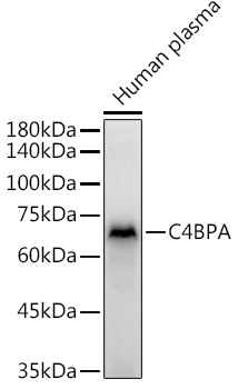 Western blot analysis of extracts of Human plasma, using C4BPA  antibody  at 1:3000 dilution