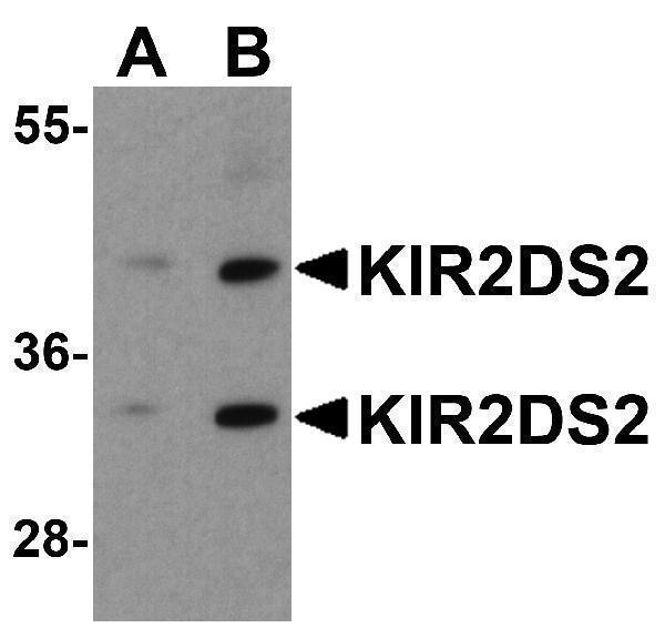 a03789 kir2ds2 primary antibodies wb testing 1