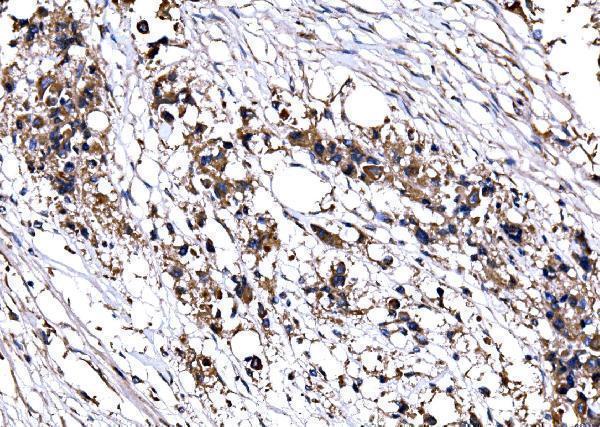  IHC analysis of IMPDH1 using anti-IMPDH1 antibody (A03791-1)