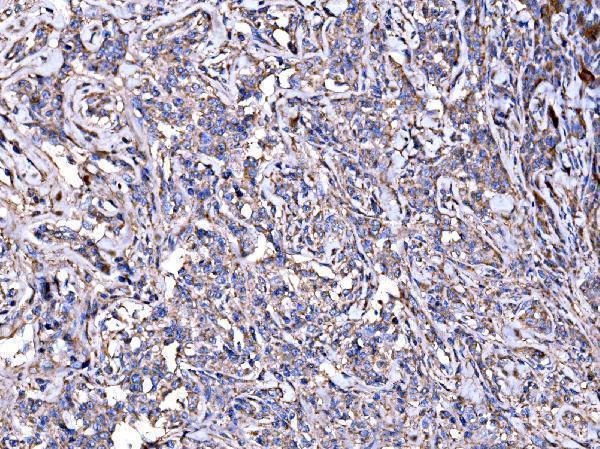 IHC analysis of IMPDH1 using anti-IMPDH1 antibody (A03791-1)