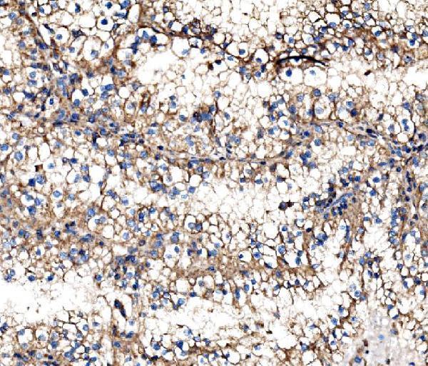 a03791 1 impdh1 primary antibodies ihc testing 4