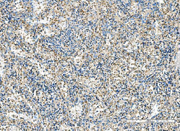 a03791 1 impdh1 primary antibodies ihc testing 5