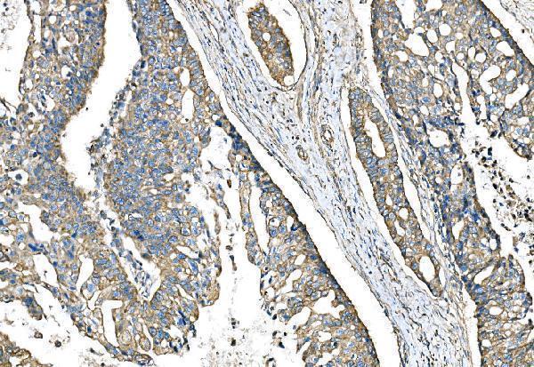 a03791 1 impdh1 primary antibodies ihc testing 6