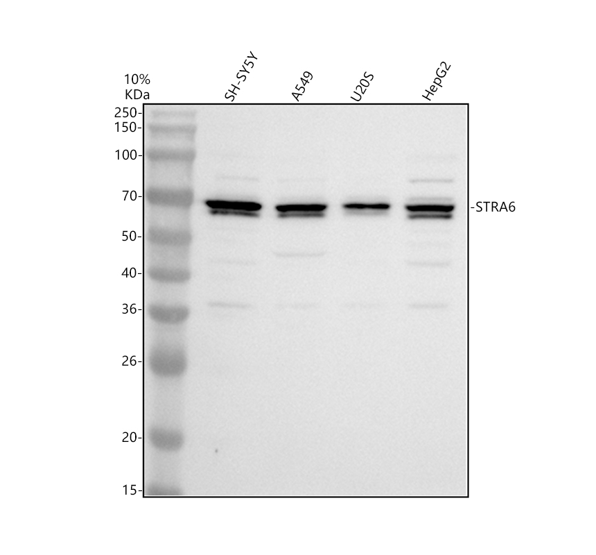 Western blot analysis of STRA6 using anti-STRA6 antibody (A03792-2)