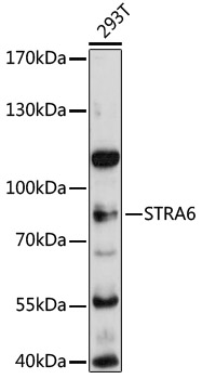 Western blot analysis of extracts of 293T cells, using STRA6 antibody  at 1:3000 dilution