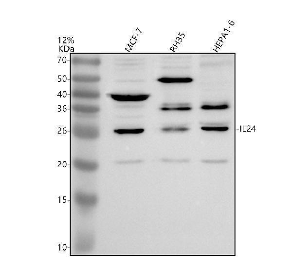 Western blot analysis of IL24 using anti-IL24 antibody (A03793-2)