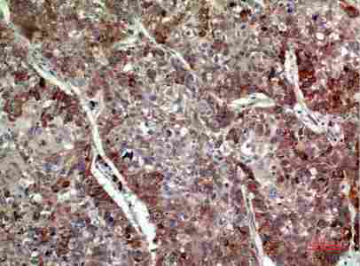 a03793 il24 primary antibodyes ihc testing 1