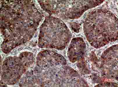 a03793 il24 primary antibodyes ihc testing 3