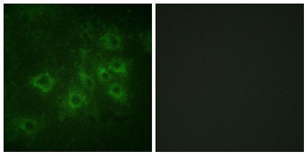 a03794s605 syn1 primary antibodies if testing 3
