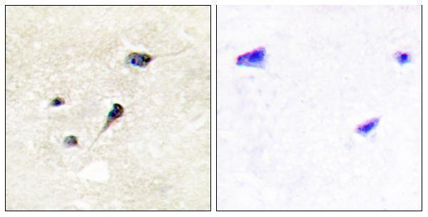 a03794s605 syn1 primary antibodies ihc testing 2