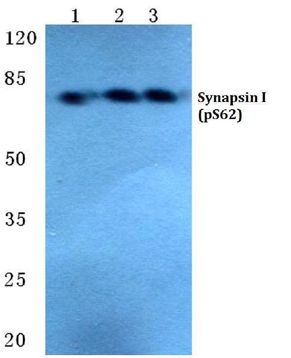 a03794s62 syn1 primary antiboties wb testing 1