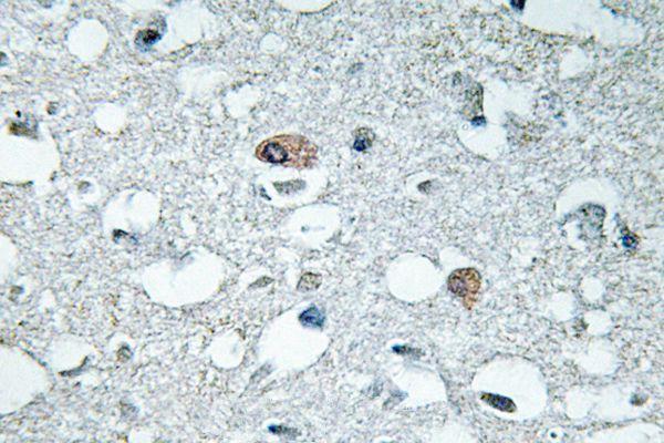 a03794s9 1 syn1 primary antiboties ihc testing 2