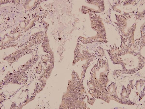 a03794t56 syn1 primary antiboties ihc testing 2