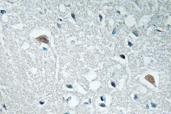 a03794y3 syn1 primary antiboties ihc testing 2