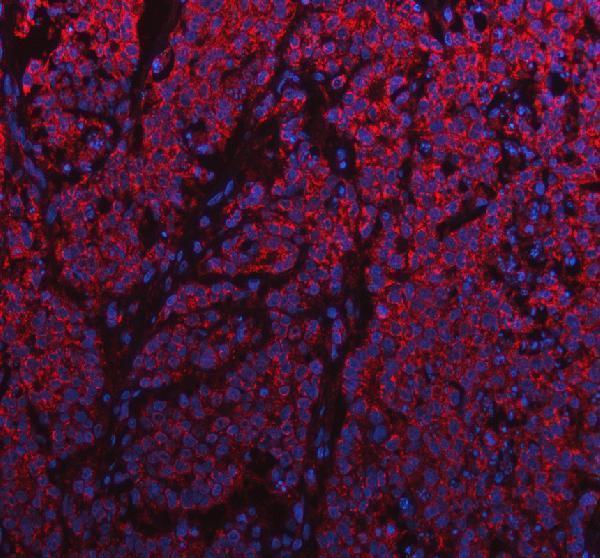 IF analysis of SNX9 using anti-SNX9 antibody (A03796-2)