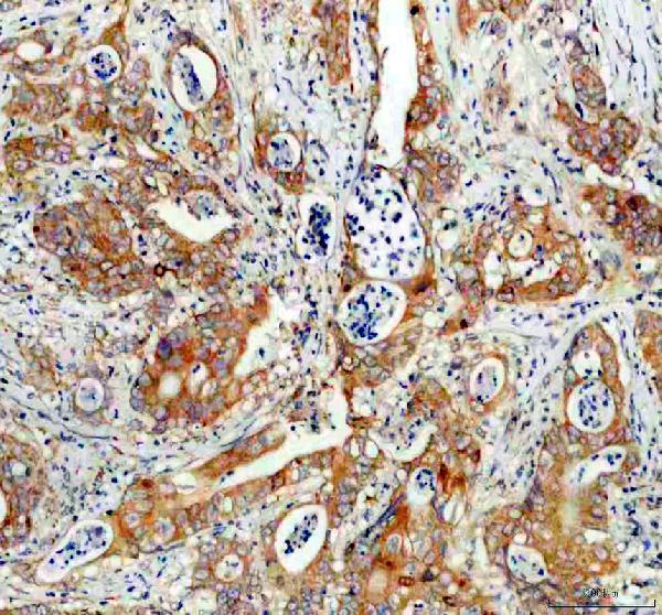 IHC analysis of SNX9 using anti-SNX9 antibody (A03796-2)
