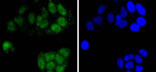 ICC staining CDC5L in Hela cells (green)