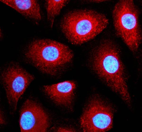 a03798 1 htatip2 primary antibodies if testing 1