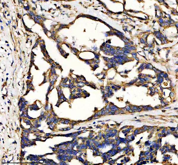 a03798 1 htatip2 primary antibodies ihc testing 1