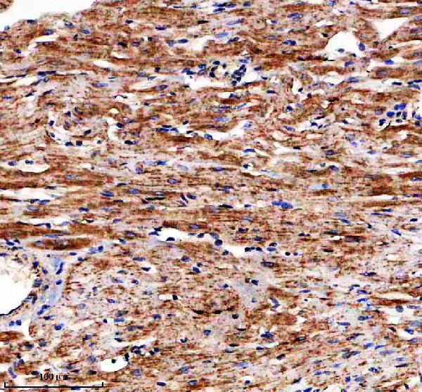 a03798 1 htatip2 primary antibodies ihc testing 2