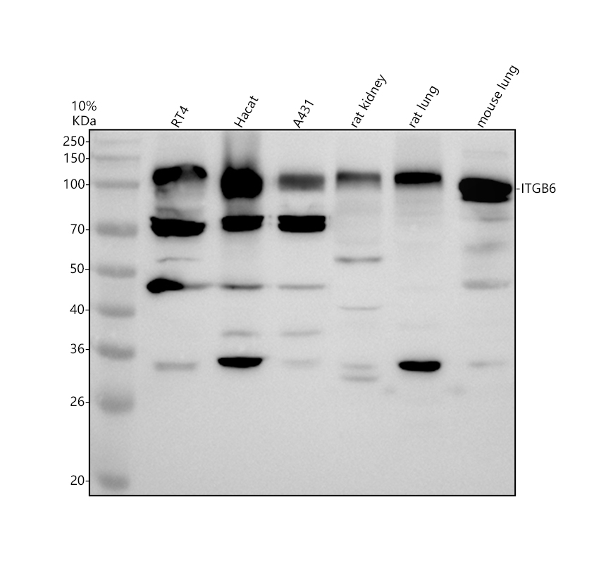 Western blot analysis of ITGB6 using anti-ITGB6 antibody (A03800)