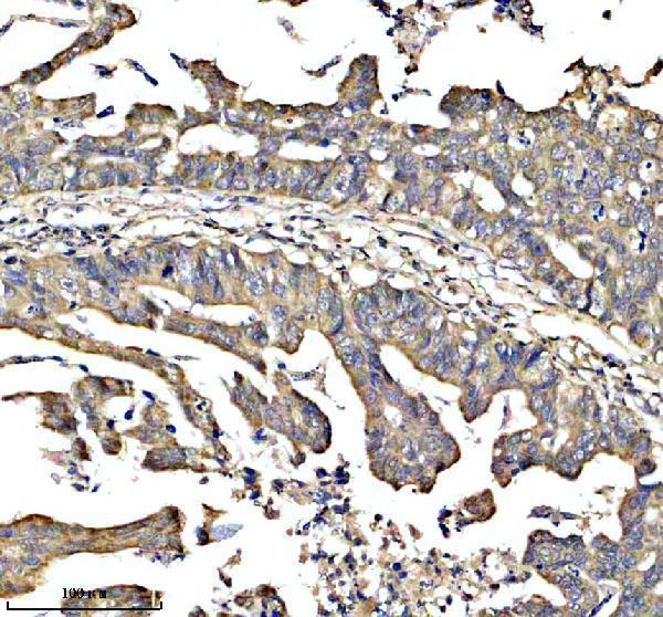 a03801 1 eif2b5 primary antibodies ihc testing 1