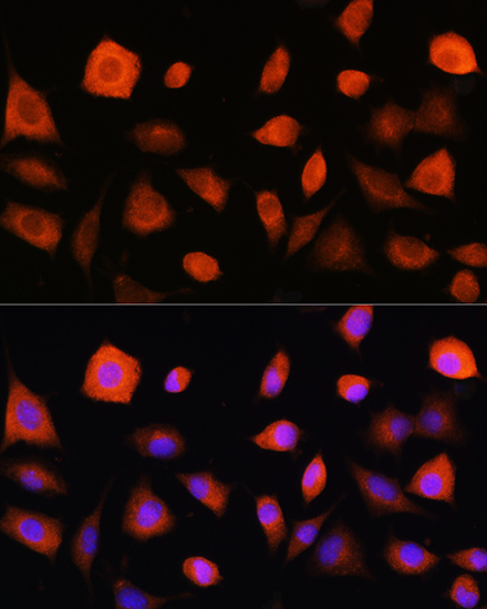 a03801 eif2b5 primary antiboties if testing 2