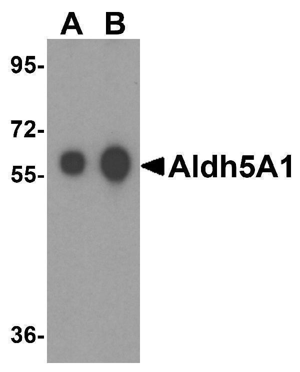 Western blot analysis of Aldh5A1 in human liver tissue lysate with Aldh5A1 antibody at (A) 0