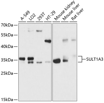 a03804 sult1a3 primary antiboties wb testing 1