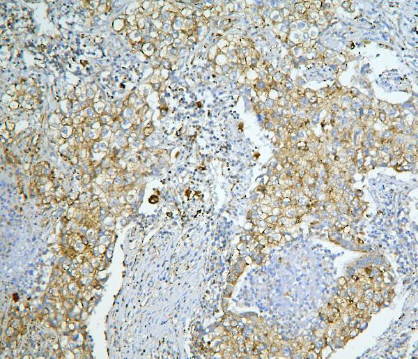 a03808 2 lonp1 primary antibodies ihc testing 5