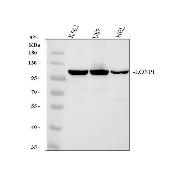  Western blot analysis of LONP1 using anti-LONP1 antibody (A03808-2)