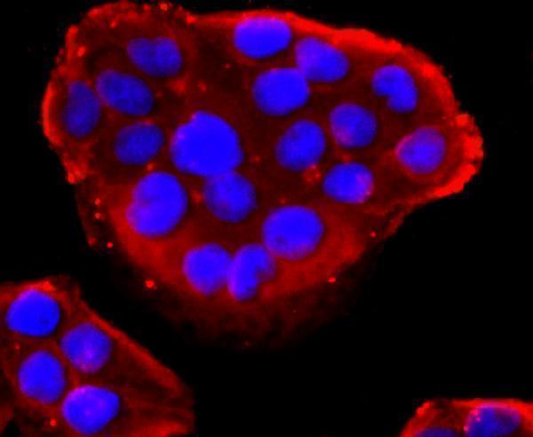 a03813 1 pdia6 primary antiboties icc testing 2