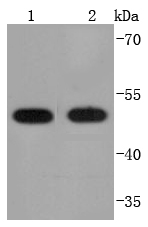 a03813 1 pdia6 primary antiboties wb testing 1