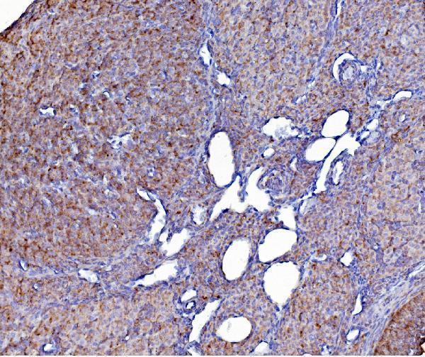 a03813 2 pdia6 primary antibodies ihc testing 2