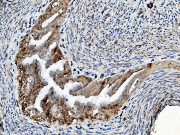 a03813 2 pdia6 primary antibodies ihc testing 3